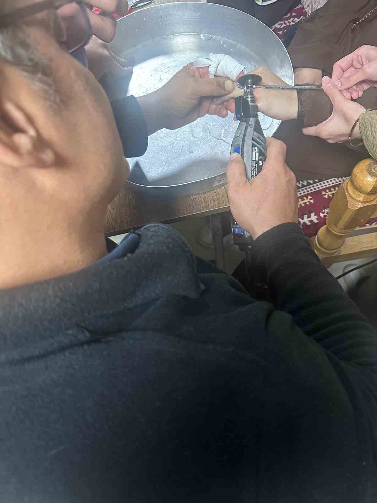 Batman'da Parmağına Yüzük Sıkışan Kişiye Hastanede Müdahale Edildi